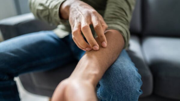 Midsection View Of A Man Sitting On Sofa Suffering From Itching